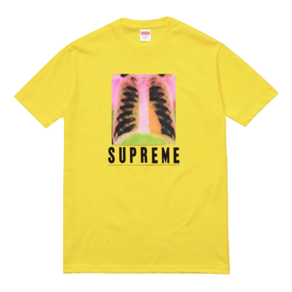 Supreme X-Ray Tee - Yellow