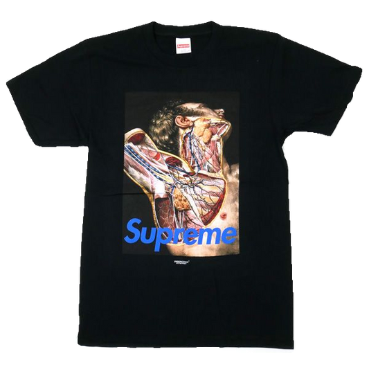 Supreme/Undercover Anatomy Tee - Black